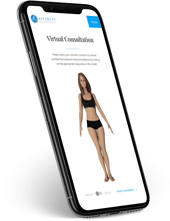 Mobile phone displaying the Virtual Consultation tool from Affinity Regen Med.